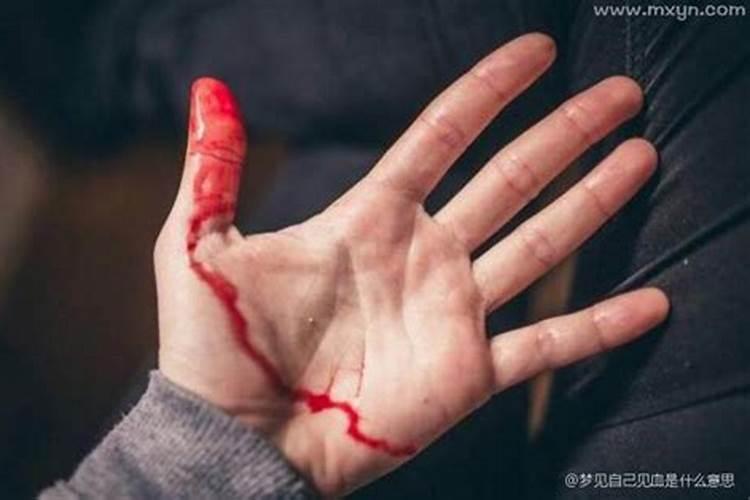 梦见一直在跑步的预兆