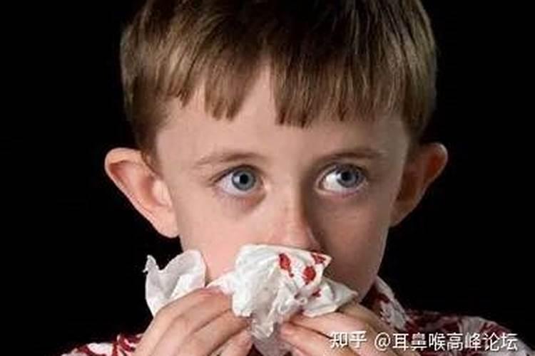 梦见别人流了好多鼻血的预兆