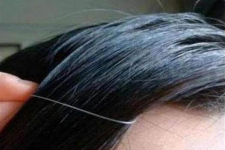 怀孕梦见被猫咬是什么意思