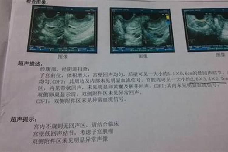 怀孕两多月发现是死胎怎么回事呀  百度宝宝知道