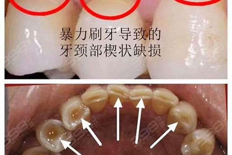 怀孕梦见掉牙流血,怀孕4个月梦见掉牙是胎梦吗