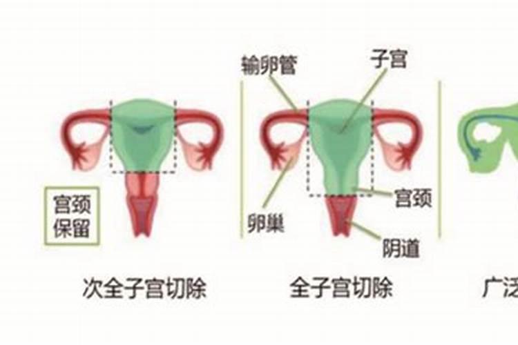 剖腹产会影响人的运势吗