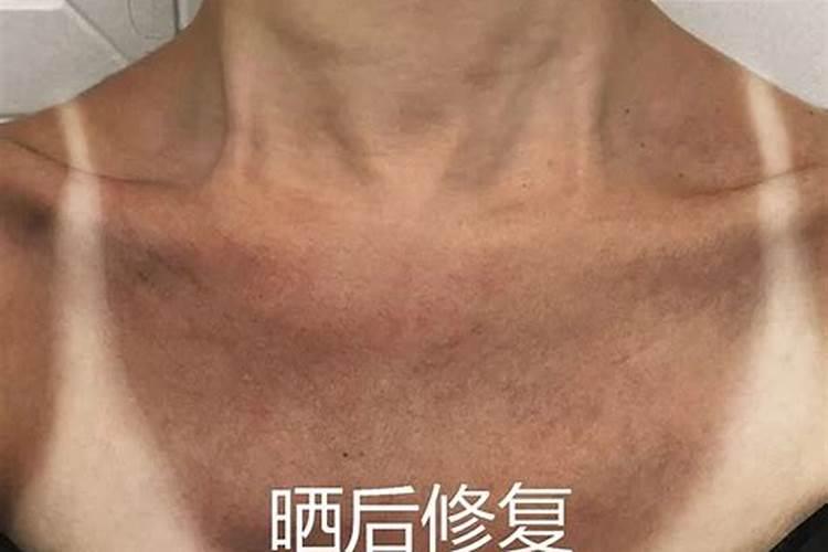 梦见自己脸被晒黑的预兆