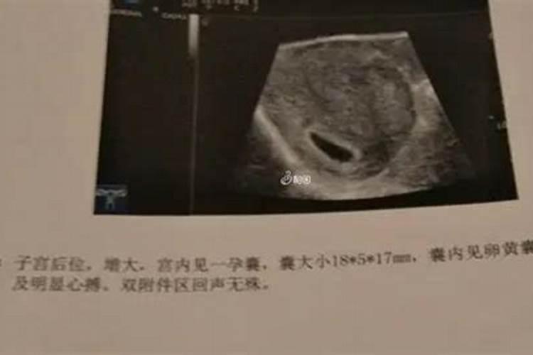 美国法律允许打b超分辨男女吗