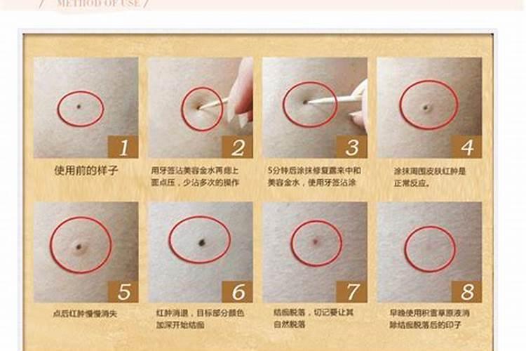 脸颊上有颗痣,要点掉吗？会影响运程吗？