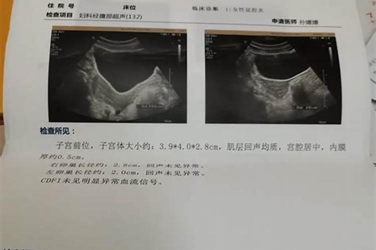 八字喜有木、火,忌土多,什么意思？