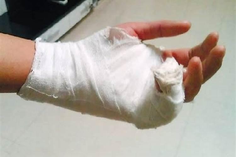 梦见自己手受伤流血的预兆