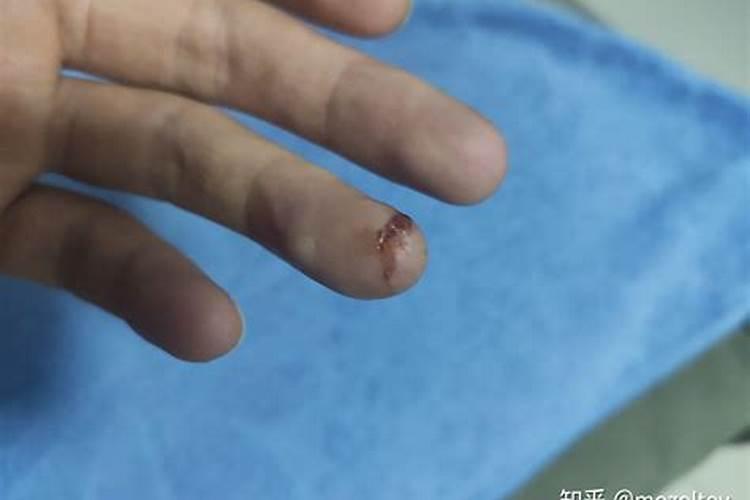 梦见梦左手腕很深的一道口子的预兆