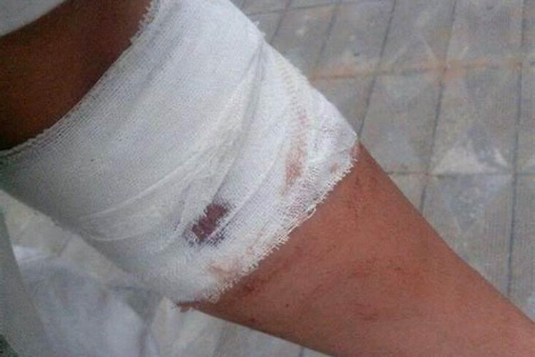 梦见自己手腕划破一个大口子