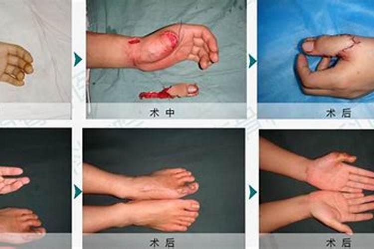 梦见梦人手和脚相煮的预兆