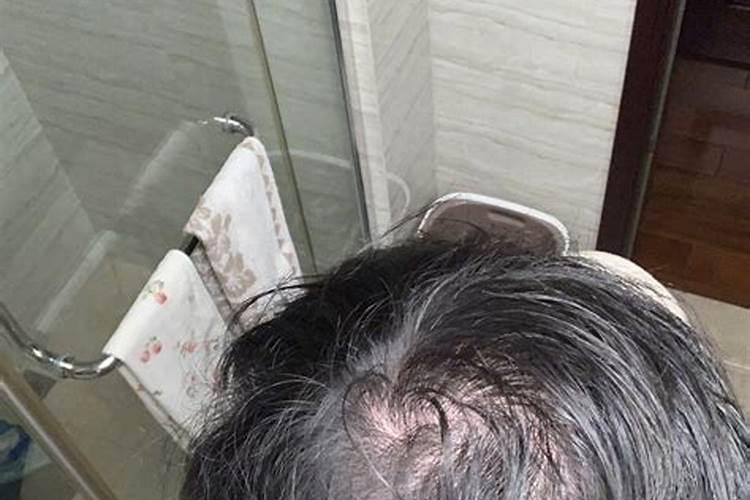 梦到自己头发秃了一块是什么预兆