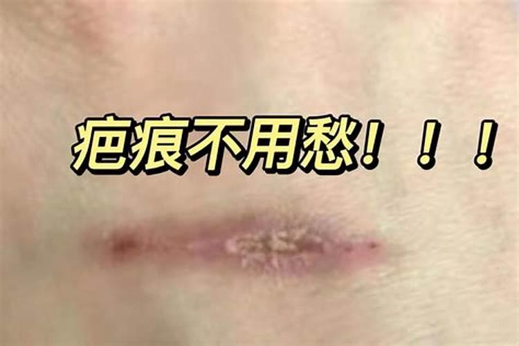 梦见老婆身上伤痕累累我放声大哭什么意思？