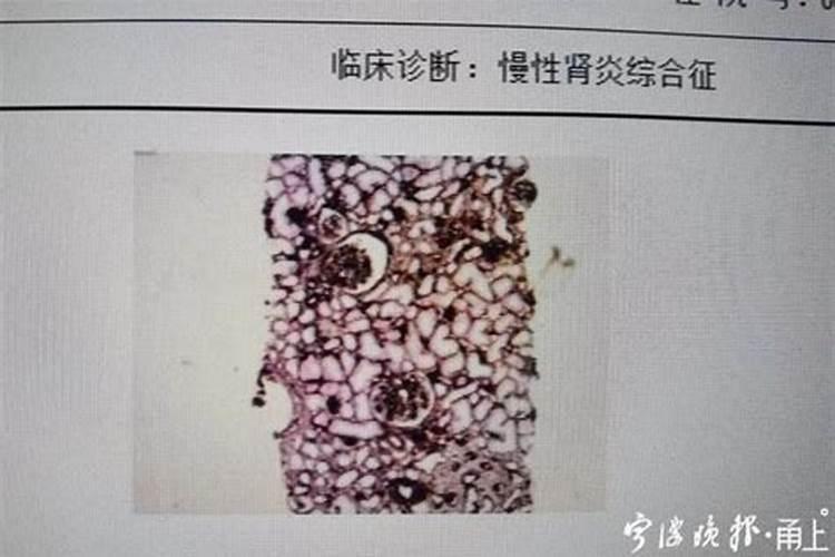 柿子树寓意