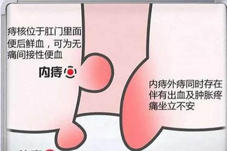 本命年红绳可以和手表一起戴吗