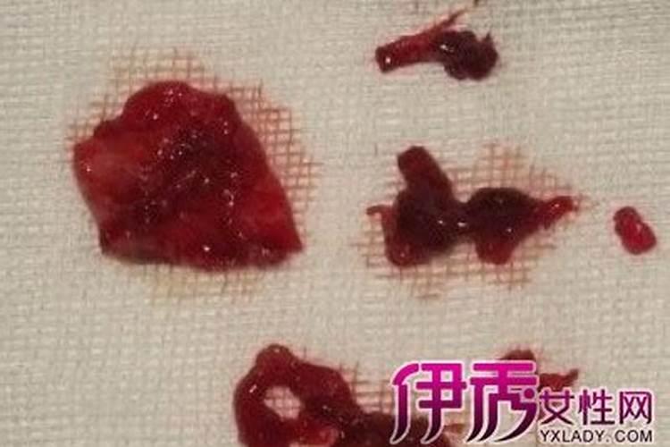 周公解梦梦到自己一直在流血