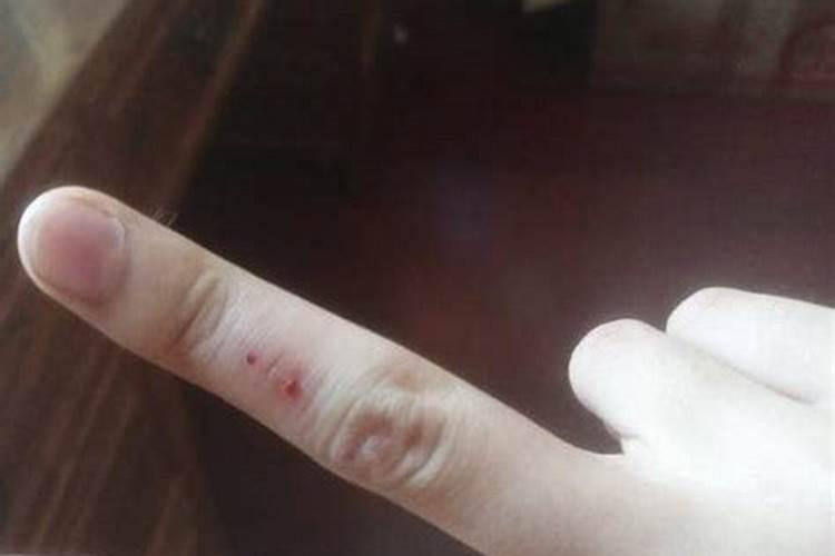 梦见自己大母指被破开取出一些东西