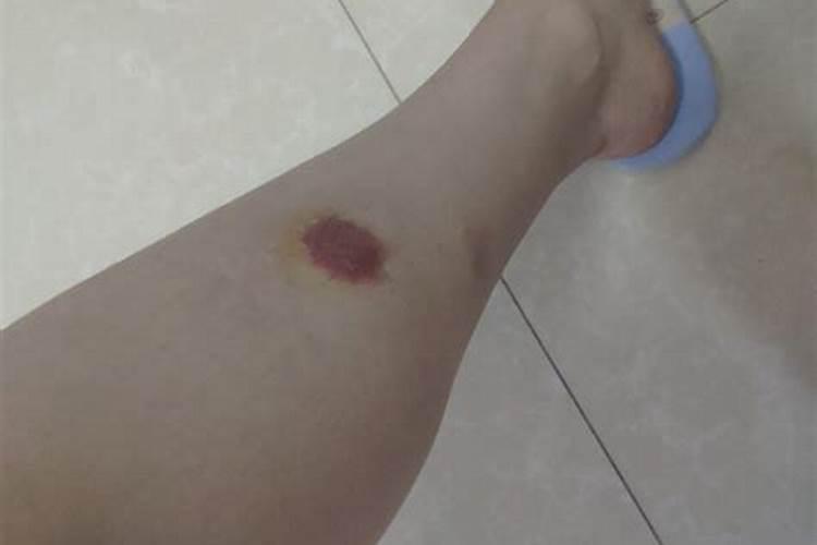 梦见脚被割破的预兆