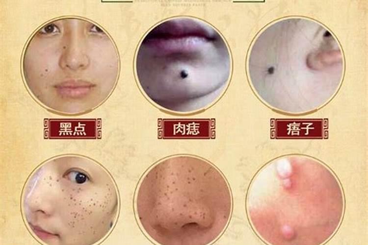 点痣后运气变了,关于面相点痣