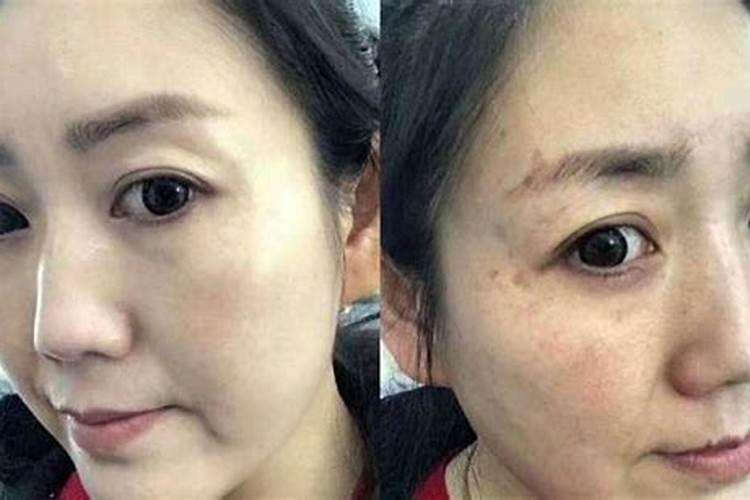 剖腹产会影响人的运势吗