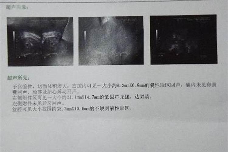 如何通过八字看孕妇生男生女