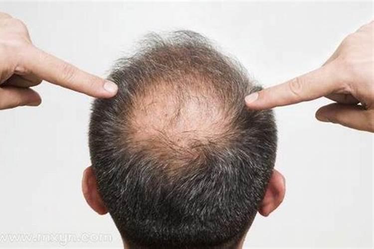 老婆怀孕了我梦到蛇是什么意思,孕妇梦到一对蛇预示着什么