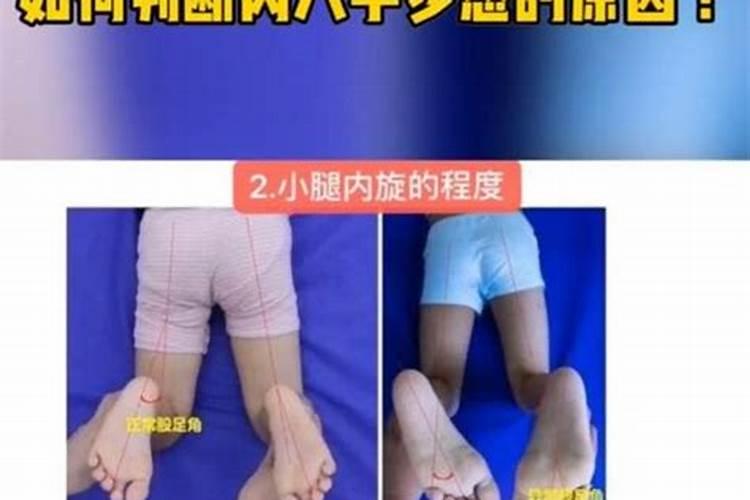 孩子走路内八字,怎么纠正？
