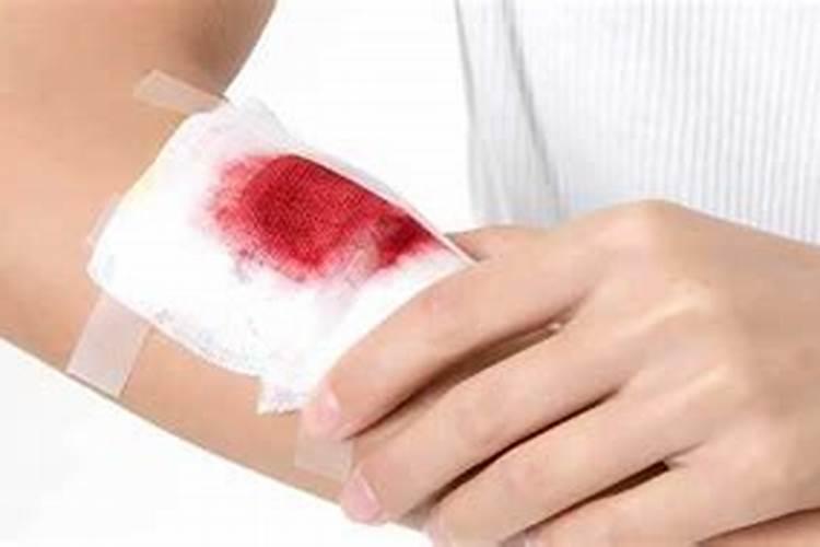 梦见手背受伤流血不止的预兆