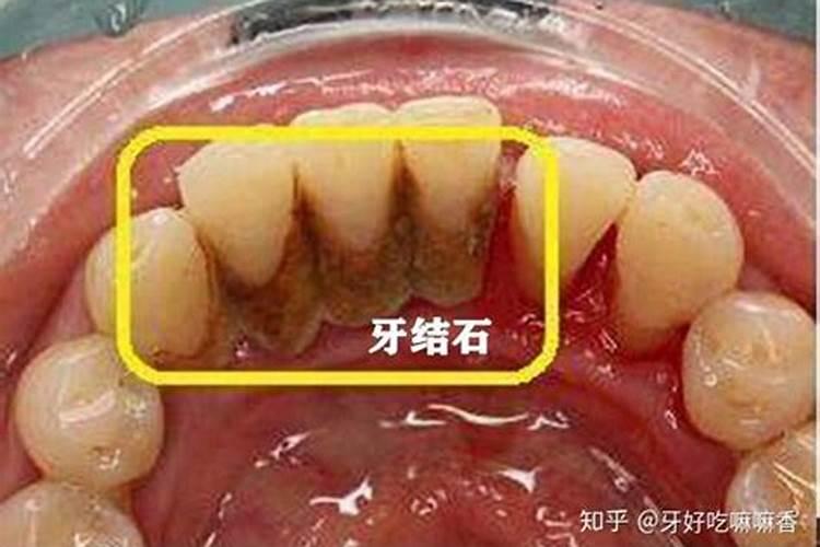 孕妇已婚女人梦见烧纸钱