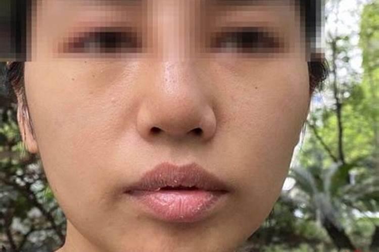 鼻子歪了是什么预兆
