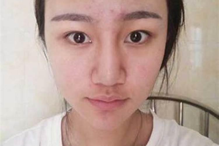 鼻子歪了是什么预兆 鼻子歪了是哪些预兆