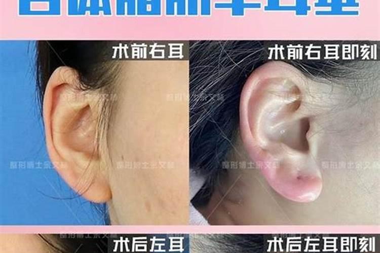 男人耳垂往上翘是什么命