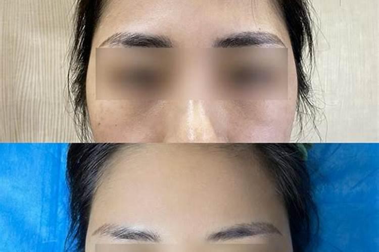 额头扁平的女人命不好吗？