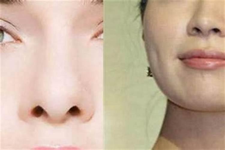 鼻子漏孔面相的女人怎么化解