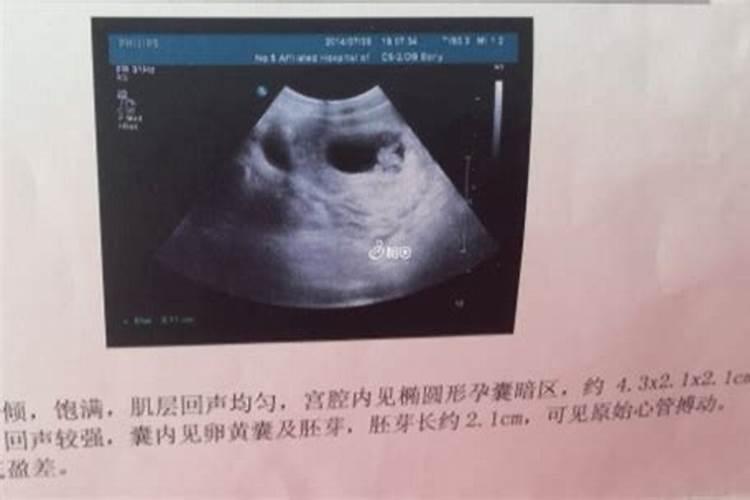 虎年犯太岁戴什么天珠,犯太岁手链戴哪只手