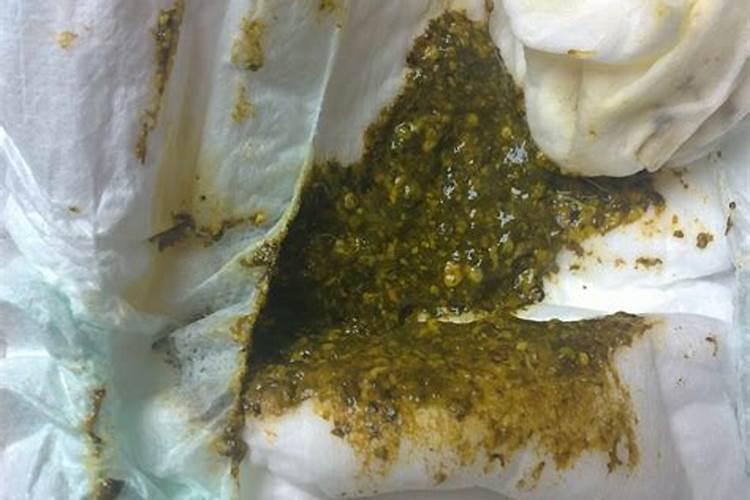 梦见屎和尿拉在身上意味着的预兆