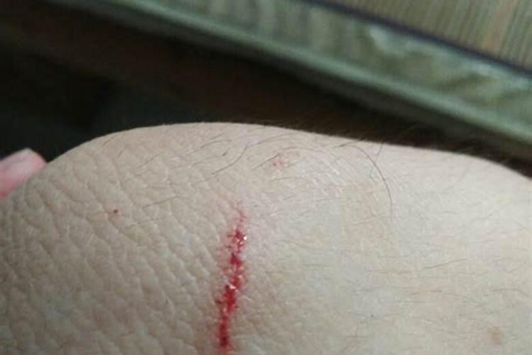 梦见被猫咬手不松口是什么预兆