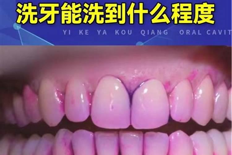 本命年化解太岁可多种方法一起用么？就是例如立春后去献血或者洗牙。然后...