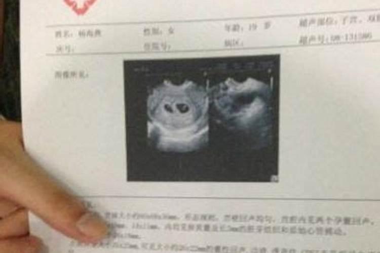 梦见人死了又活了是什么意思