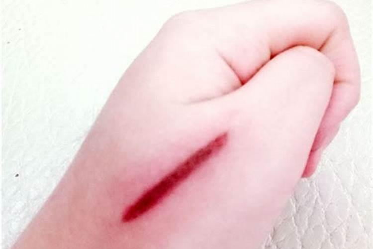 孕妇梦见手上伤口很深不见血