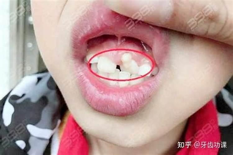 梦见结冰的马路