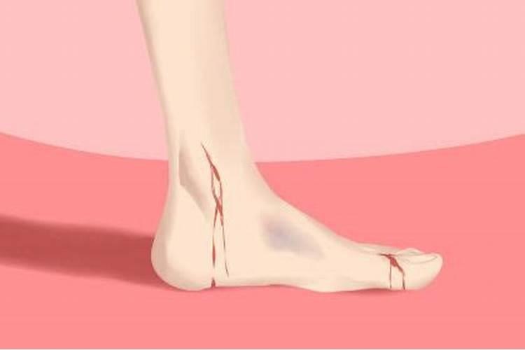 女人梦见脚出血是吉兆