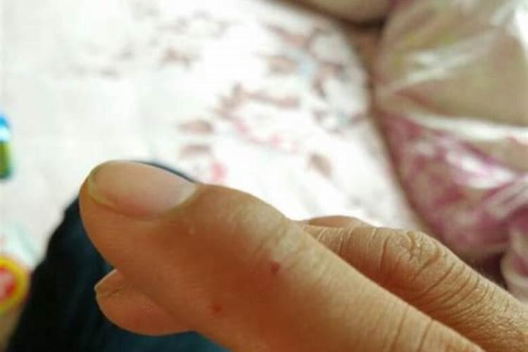 梦见被小孩咬破了手的预兆