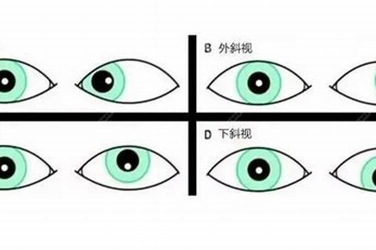 左眼睛有斜视的感情命运