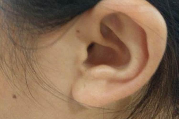 耳廓外翻的人真的命不好吗 女生耳骨外翻有福 ？
