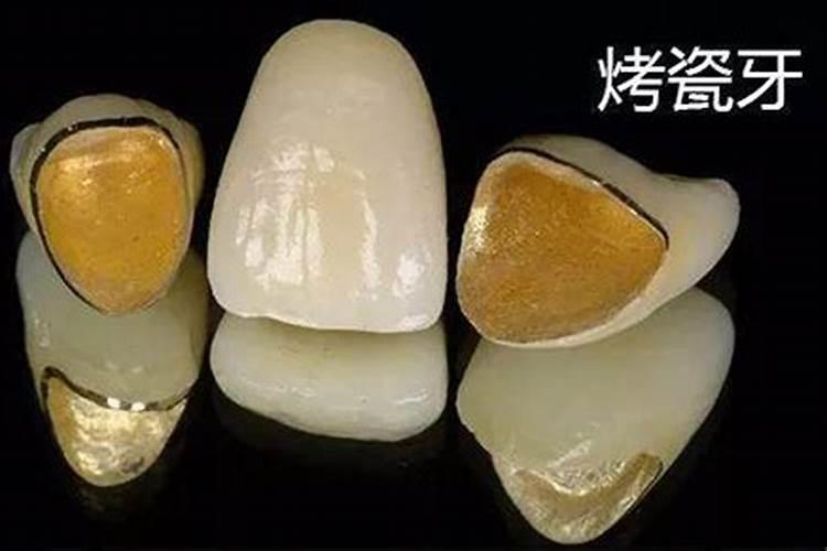 梦见假牙掉了 梦见假牙掉了 会有什么征兆