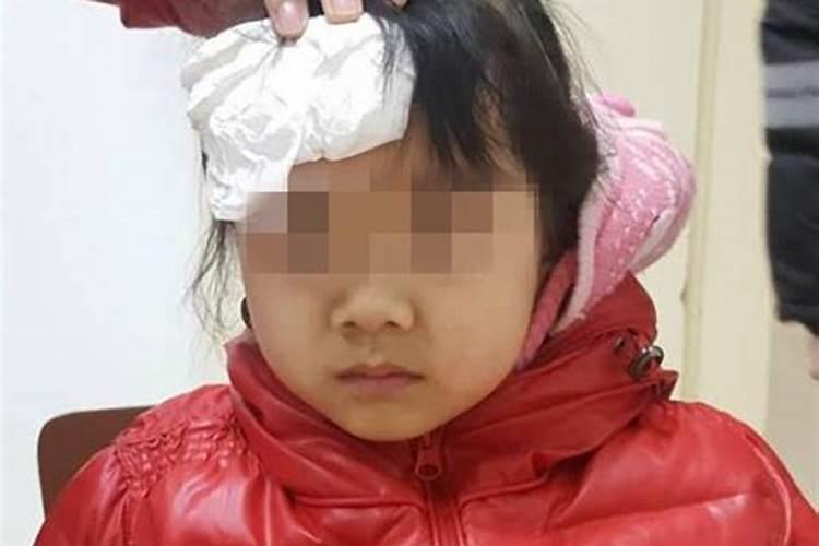 孕妇梦见孩子头摔破了流血