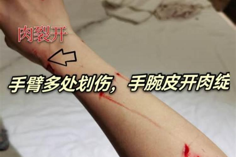 梦见自己被人用刀捅伤流血