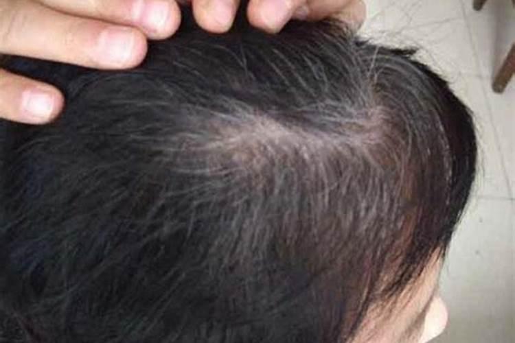 梦到头顶有根白发,梦见自己头发根部变白