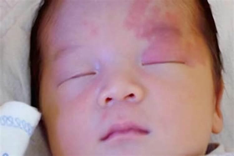 由身上胎记看人一生整体运势