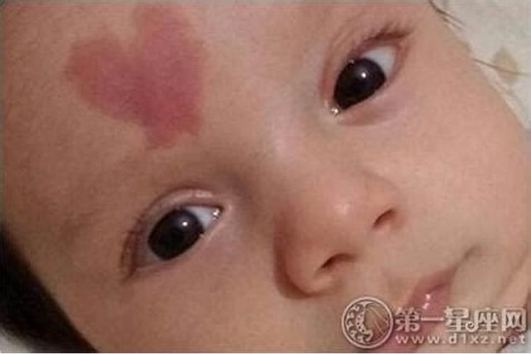 肚子上长胎记寓意什么